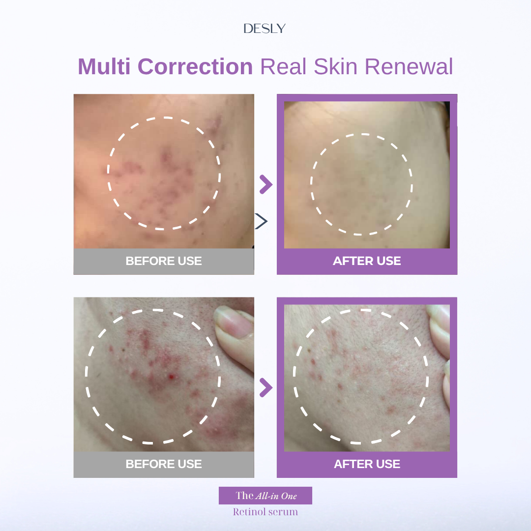 The All-In-One Retinol Serum 30ml