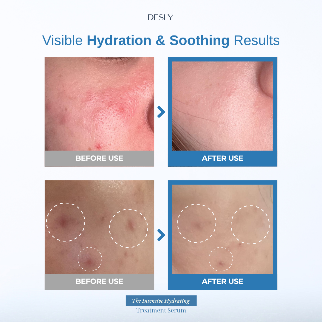 The Intensive Hydrating Treatment Serum 30ml