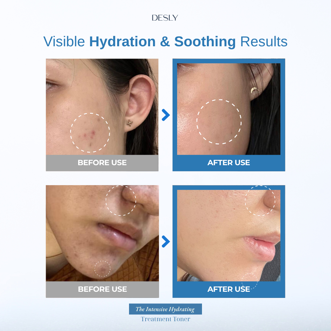 The Intensive Hydrating Treatment Toner 100ml