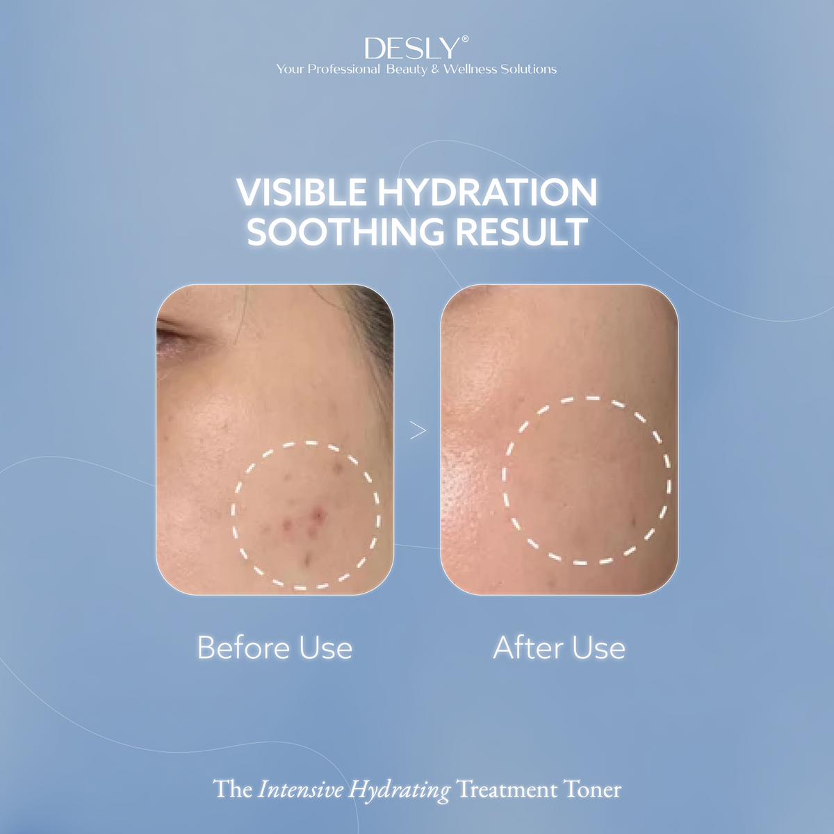 The Intensive Hydrating Treatment Toner 100ml