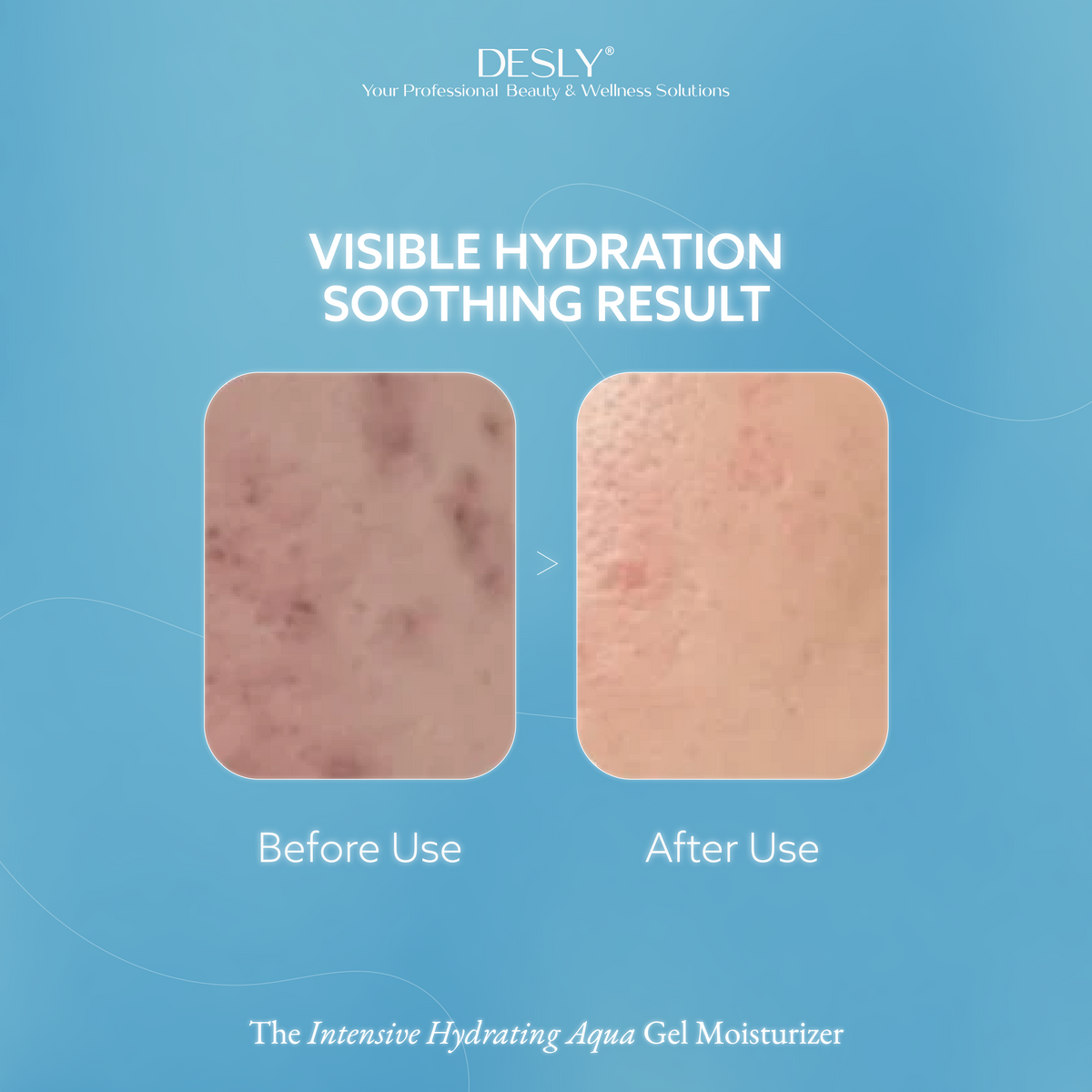 The Intensive Hydrating Aqua Gel Moisturizer 50ml