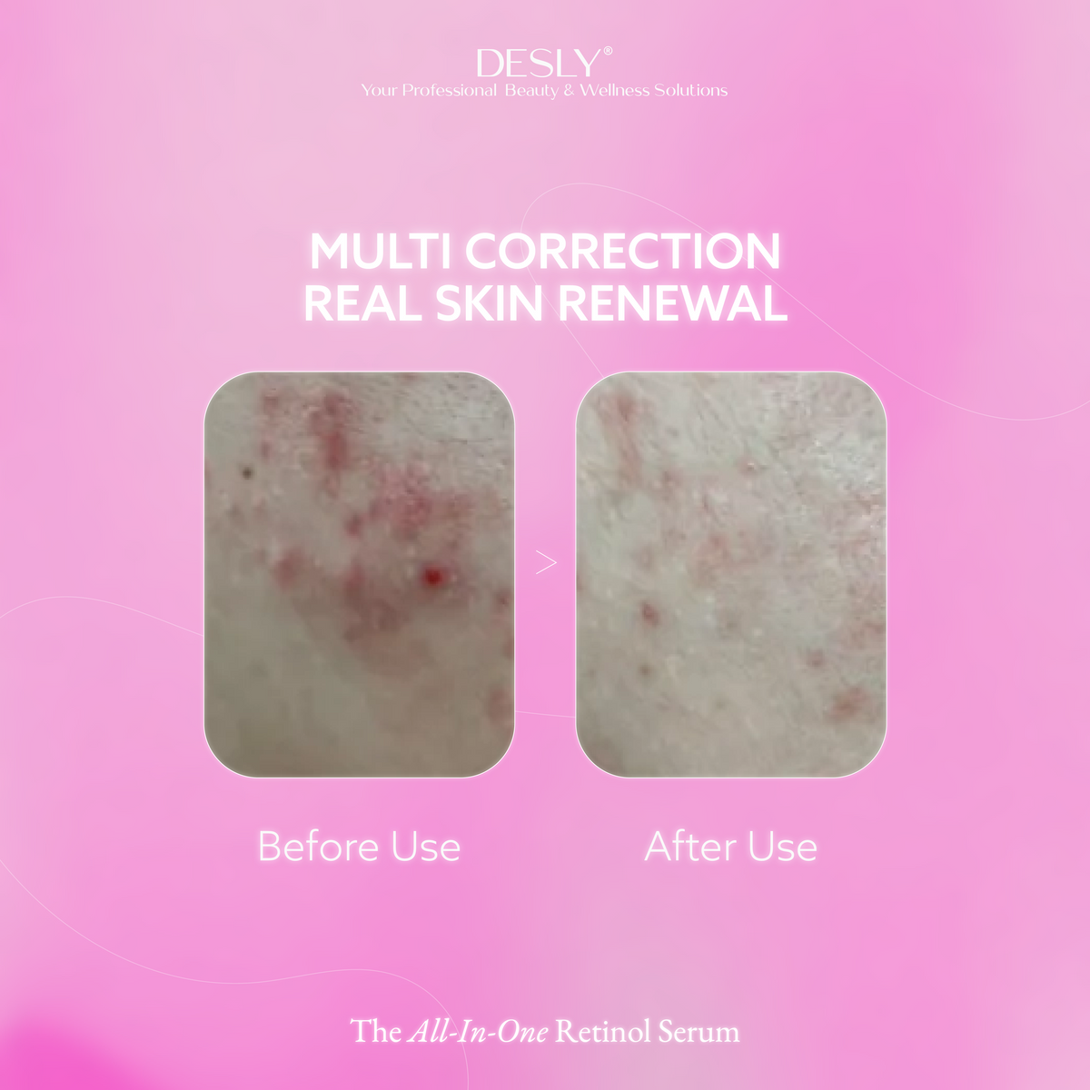 The All-In-One Retinol Serum 30ml