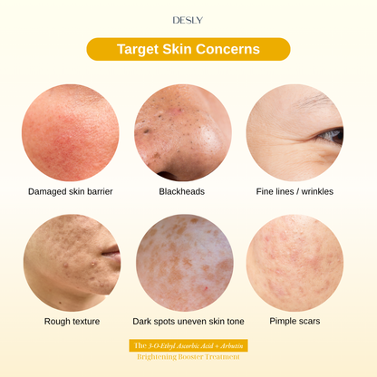 The 3-O-Ethyl Ascorbic Acid + Arbutin Brightening Booster Treatment 30ml