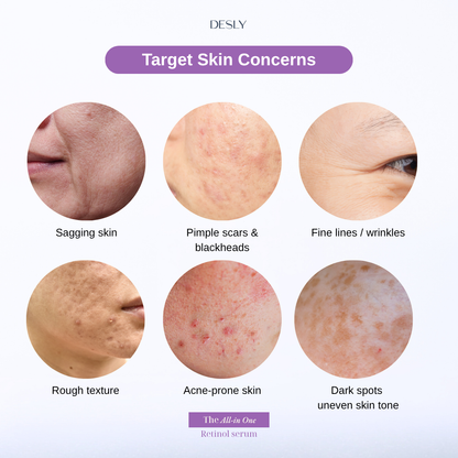 The All-In-One Retinol Serum 30ml
