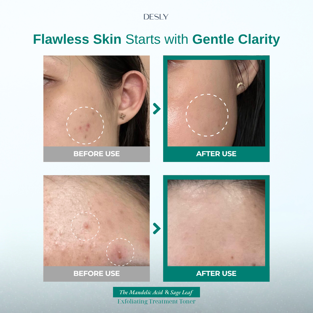 The Mandelic Acid & Sage Leaf Exfoliating Treatment Toner 100ml