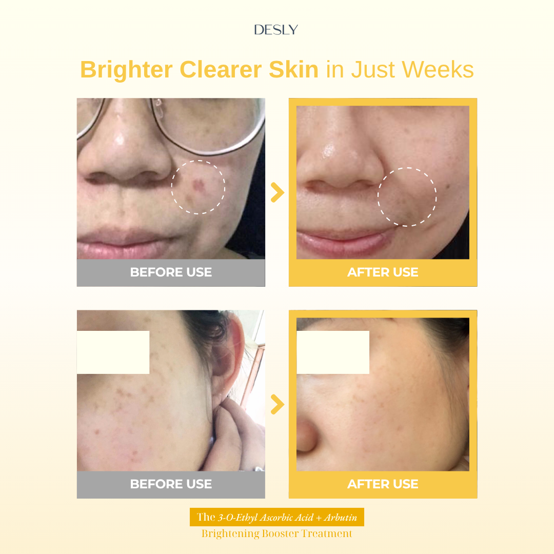 The 3-O-Ethyl Ascorbic Acid + Arbutin Brightening Booster Treatment 30ml