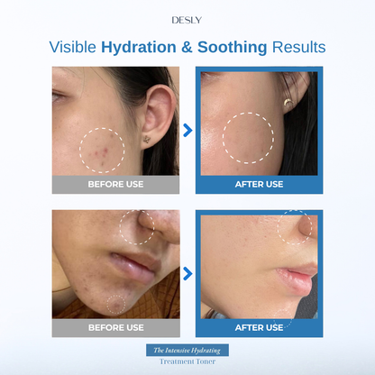 The Intensive Hydrating Treatment Toner 100ml