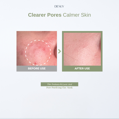 The Prebiotics & Lactic Acid Pore Purifying Clay Mask 80ml