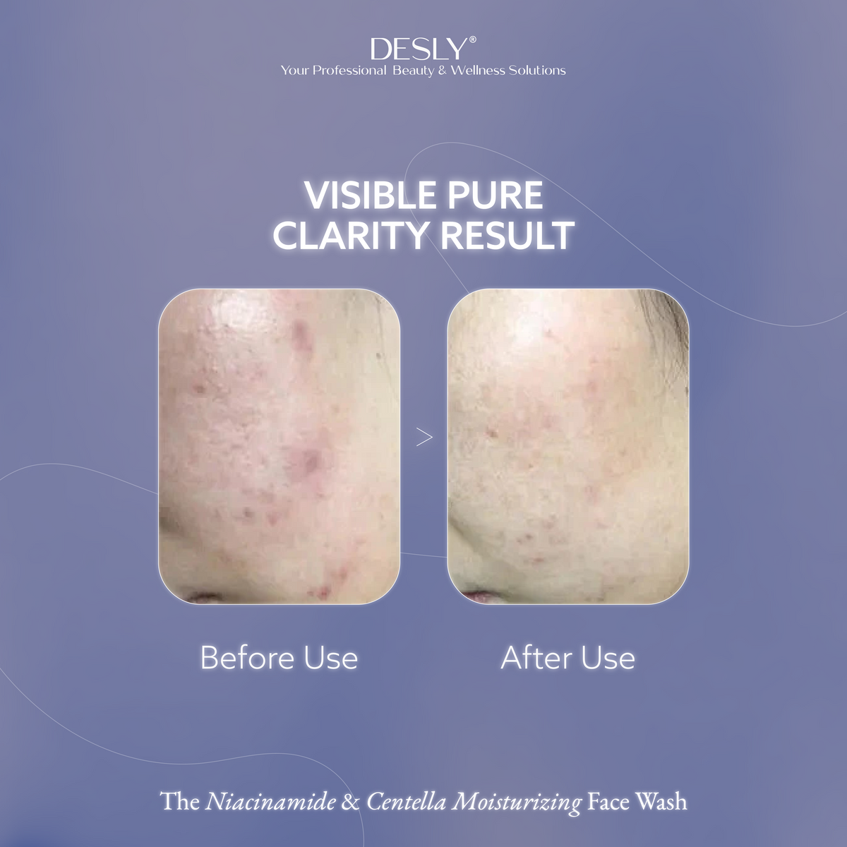 The Niacinamide & Centella Moisturizing Face Wash 100ml