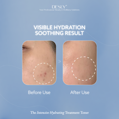 The Intensive Hydrating Treatment Toner 100ml
