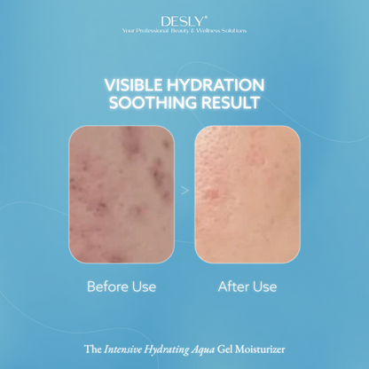 The Intensive Hydrating Aqua Gel Moisturizer 50ml