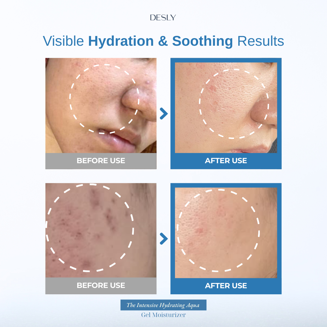 The Intensive Hydrating Aqua Gel Moisturizer 50ml
